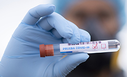 В Ханты-Мансийске 43 случая заражения COVID-19 за выходные
